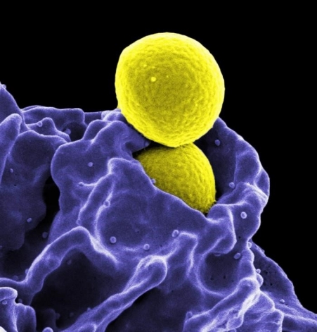 Healthcare-Associated Infections: Methicillin-resistant Staphylococcus aureus (MRSA)