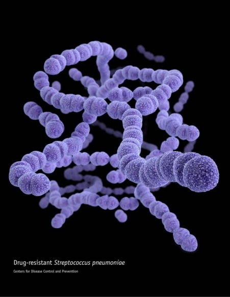 Streptococcus pneumoniae Invasive Disease (IPD)