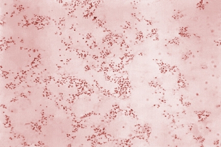 Tularemia (Francisella tularensis)